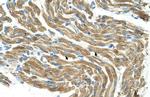 HAL Antibody in Immunohistochemistry (IHC)