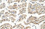 ALDH4A1 Antibody in Immunohistochemistry (IHC)