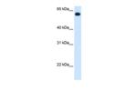 ALDH4A1 Antibody in Western Blot (WB)