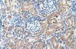 SGPP2 Antibody in Immunohistochemistry (IHC)