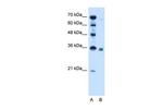 SGPP2 Antibody in Western Blot (WB)