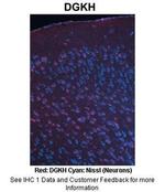 DGKH Antibody in Immunohistochemistry (IHC)