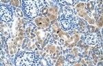 CBS Antibody in Immunohistochemistry (IHC)