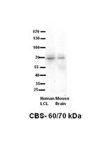 CBS Antibody in Western Blot (WB)