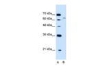 CBS Antibody in Western Blot (WB)