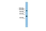 GART Antibody in Western Blot (WB)