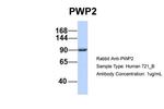 PWP2 Antibody in Western Blot (WB)