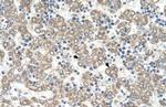 KYNU Antibody in Immunohistochemistry (IHC)