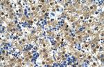 CTPS Antibody in Immunohistochemistry (IHC)