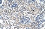 PPAT Antibody in Immunohistochemistry (IHC)