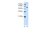 PPAT Antibody in Western Blot (WB)