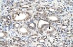 DFNA5 Antibody in Immunohistochemistry (IHC)