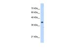 PDSS1 Antibody in Western Blot (WB)