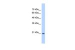 GINS2 Antibody in Western Blot (WB)