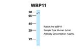 WBP11 Antibody in Western Blot (WB)