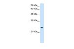 PPCDC Antibody in Western Blot (WB)