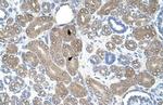 ST3GAL5 Antibody in Immunohistochemistry (IHC)