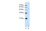 ST3GAL5 Antibody in Western Blot (WB)