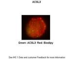 ACSL3 Antibody in Immunocytochemistry (ICC/IF)