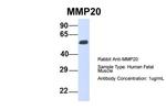 MMP20 Antibody in Western Blot (WB)