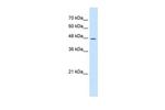 DDOST Antibody in Western Blot (WB)