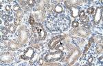 UST Antibody in Immunohistochemistry (IHC)