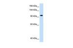 SEC63 Antibody in Western Blot (WB)