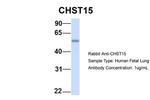 CHST15 Antibody in Western Blot (WB)