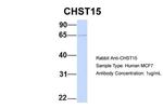 CHST15 Antibody in Western Blot (WB)