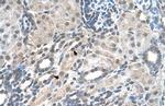 PIGV Antibody in Immunohistochemistry (IHC)