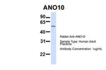 TMEM16K Antibody in Western Blot (WB)