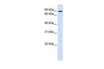 TMEM16K Antibody in Western Blot (WB)