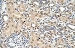 TMEM30A Antibody in Immunohistochemistry (Paraffin) (IHC (P))