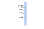 ADCY10 Antibody in Western Blot (WB)