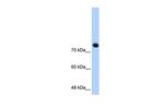 SMC3 Antibody in Western Blot (WB)