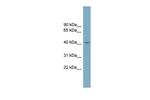 SLC30A8 Antibody in Western Blot (WB)