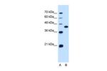 SLC14A1 Antibody in Western Blot (WB)