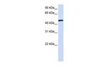 UMPS Antibody in Western Blot (WB)