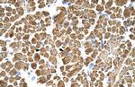 TPM2 Antibody in Immunohistochemistry (IHC)