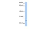 RABL4 Antibody in Western Blot (WB)