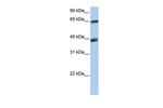 Transketolase Antibody in Western Blot (WB)