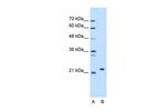 SDF2 Antibody in Western Blot (WB)