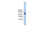 POLR3B Antibody in Western Blot (WB)