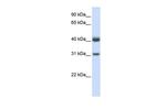 PDSS2 Antibody in Western Blot (WB)