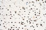 PGS1 Antibody in Immunohistochemistry (IHC)