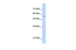 PGS1 Antibody in Western Blot (WB)