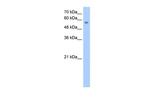 NUDT12 Antibody in Western Blot (WB)