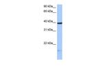 HS3ST5 Antibody in Western Blot (WB)