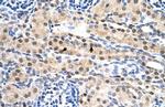 SULF2 Antibody in Immunohistochemistry (IHC)