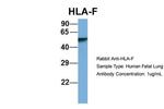 HLA-F Antibody in Western Blot (WB)